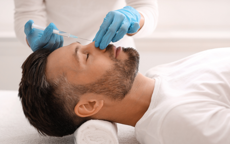 Nam giới nên nâng mũi bằng sụn sườn không? Tiêu chuẩn nâng mũi nam đẹp tự nhiên